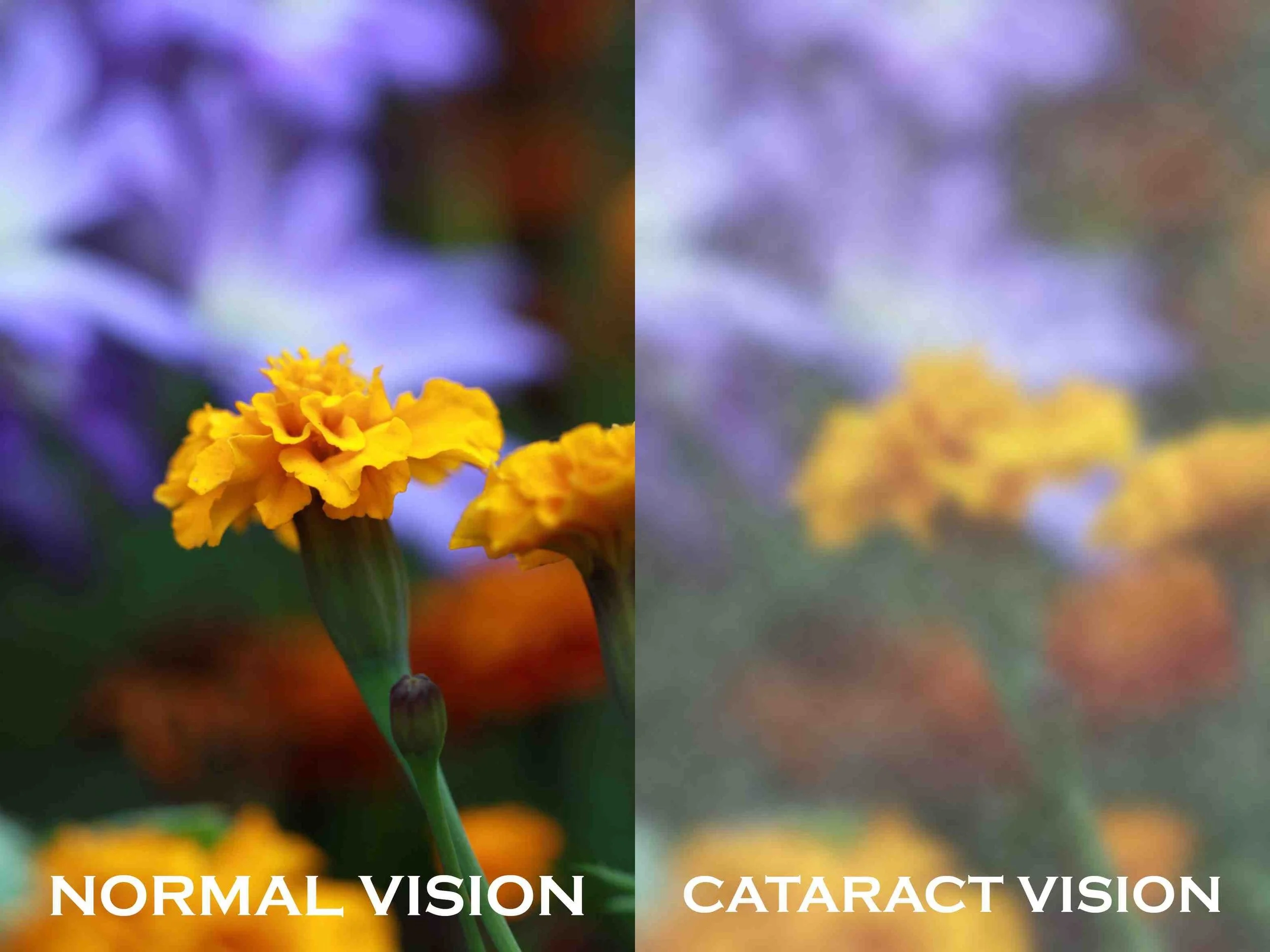 Fireworks Eye Safety & Cataract Awareness Month