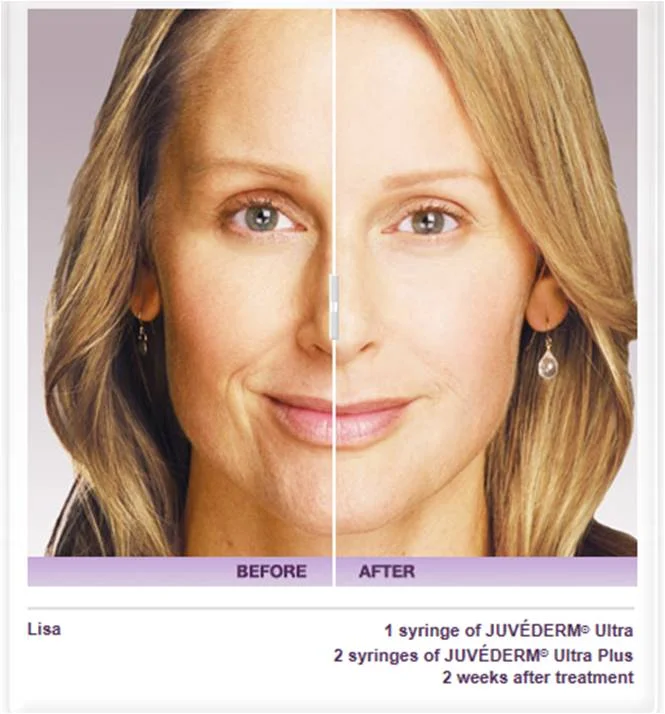 Facials, Fillers & Fun Event! 