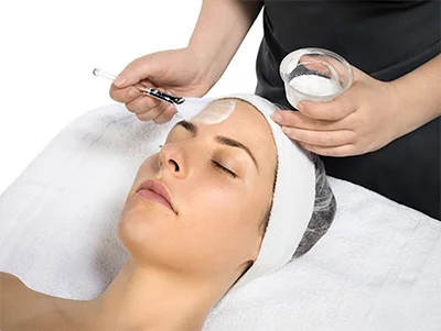 Winter is the Best Time for a Chemical Peel