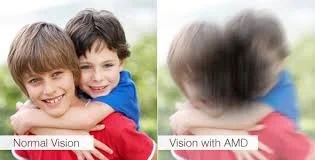 February is Age-Related Macular Degeneration Awareness Month.