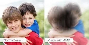 February is Age-Related Macular Degeneration Month