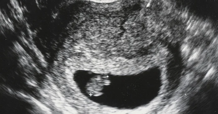 With grace and intelligence, Seth speaks courageously for the millions of innocent unborn children who have no voice. His message and ministry are vital for the church in the 21st century.