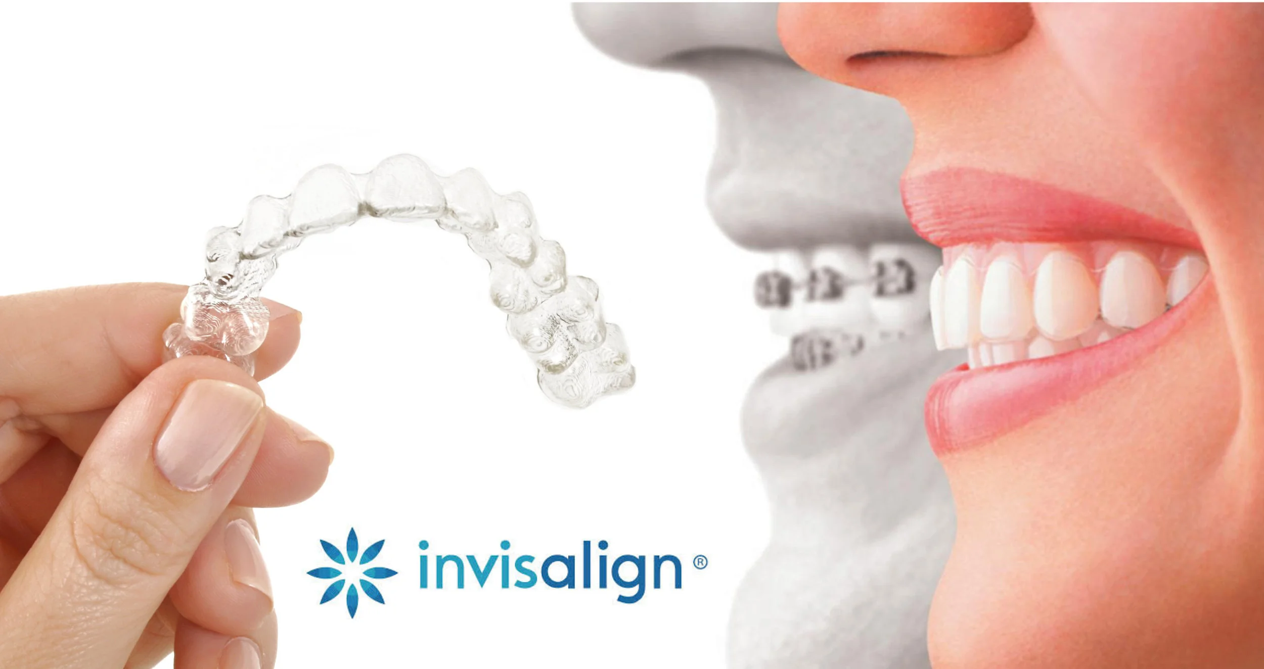 invisalign-clairemont.jpg