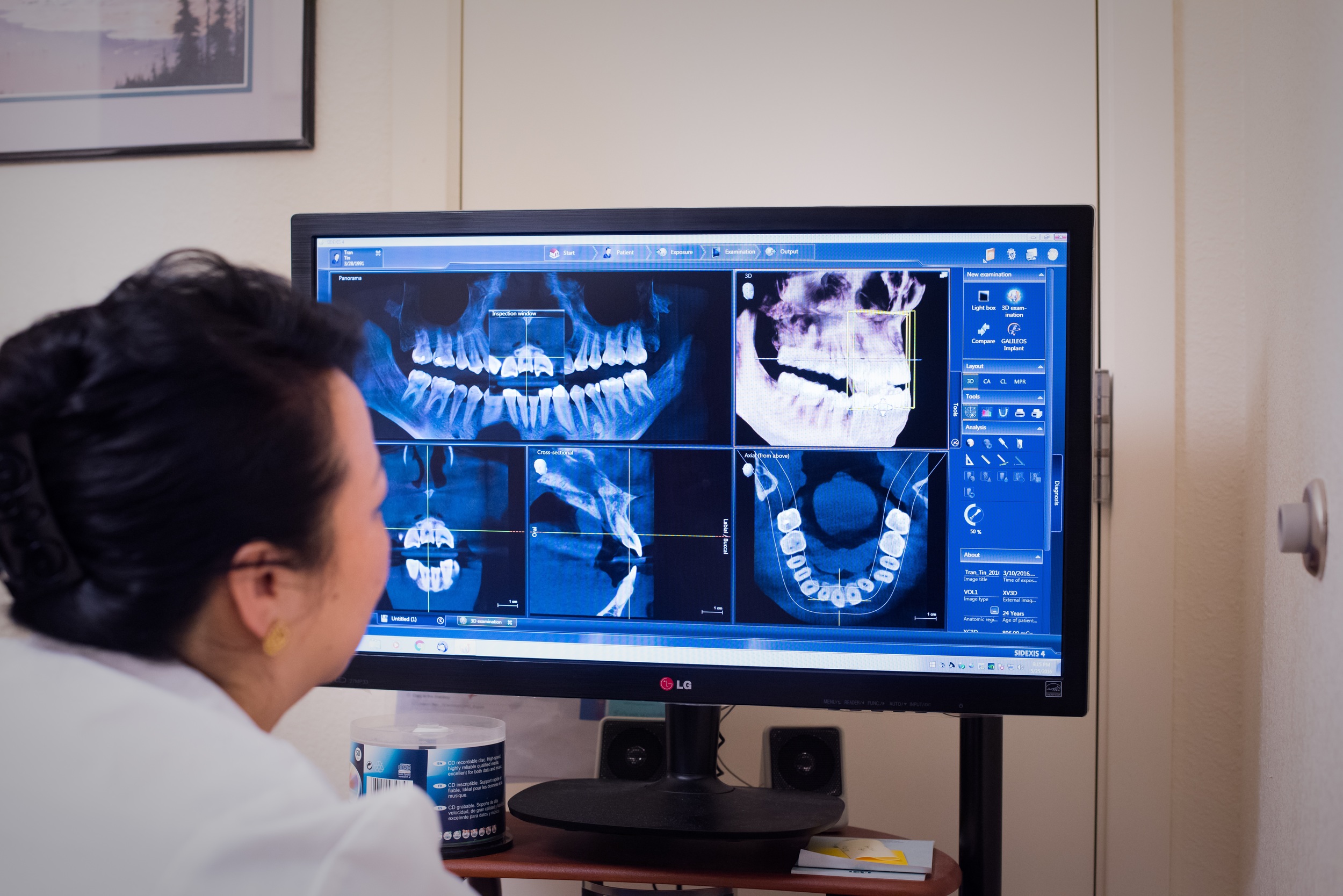 Planning with Sirona's 3D Data