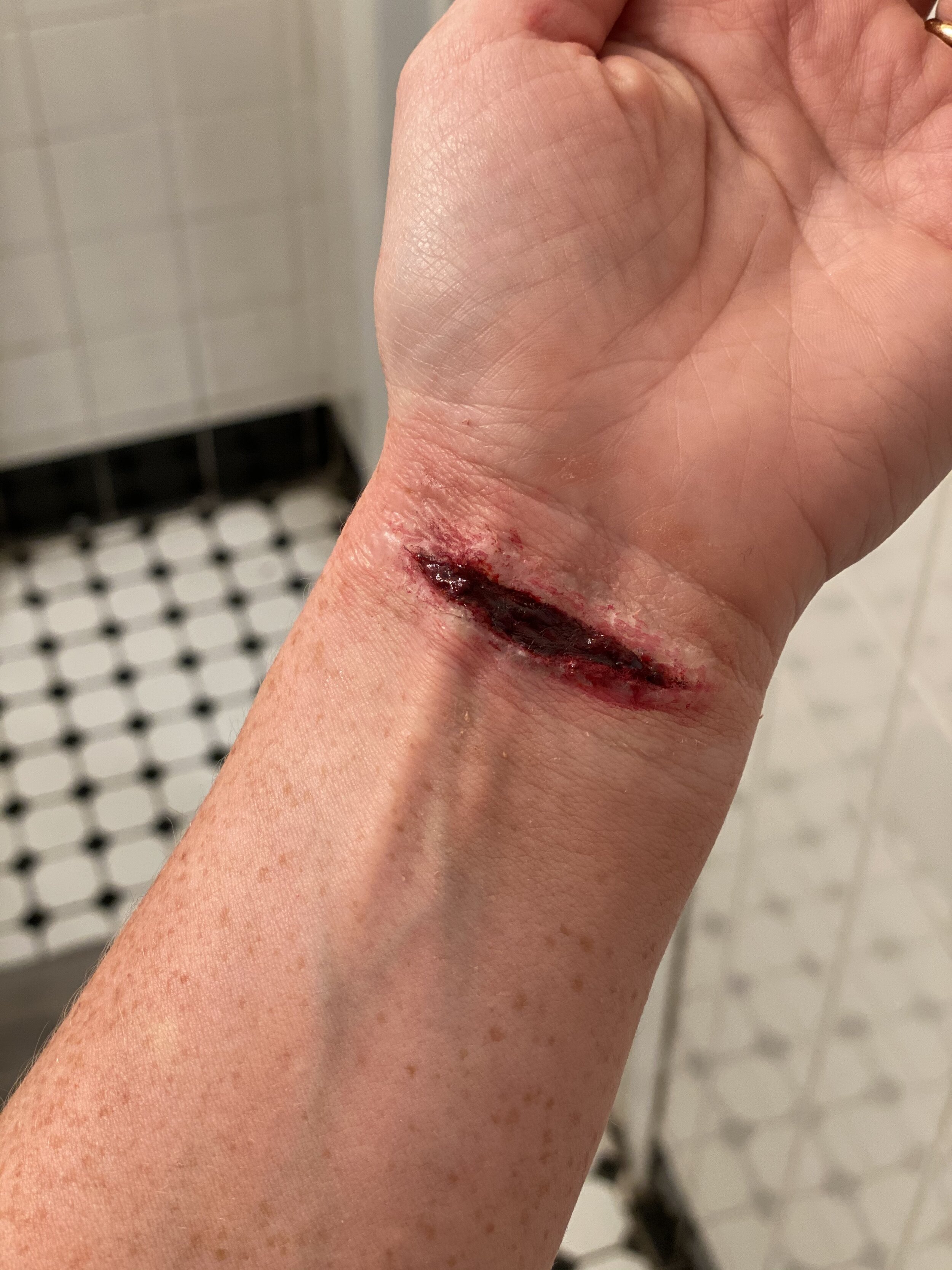 Wrist Cut.jpg