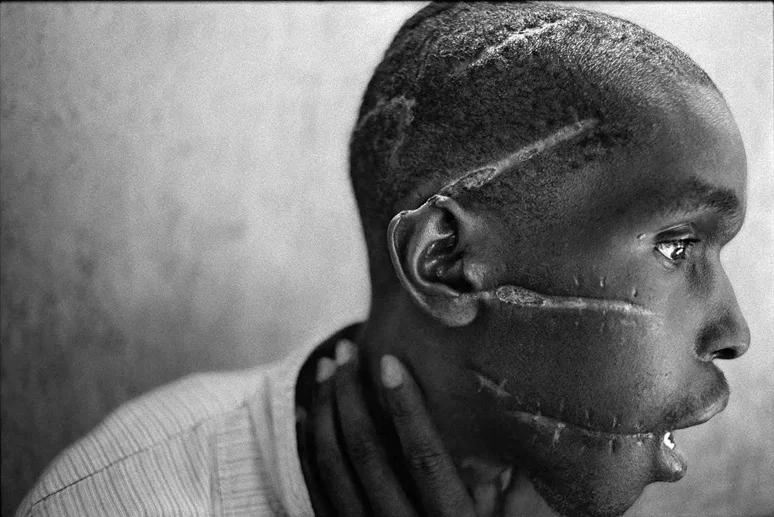 James Nachtwey, A Hutu man at a Red Cross hospital in Nyanza, Rwanda, 1994 Placement: CHEST & ABS | BACK & GLUTES |