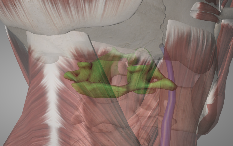 First cervical vertebra (green) aka "atlas"