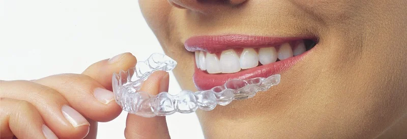 Invisalign Header.jpg