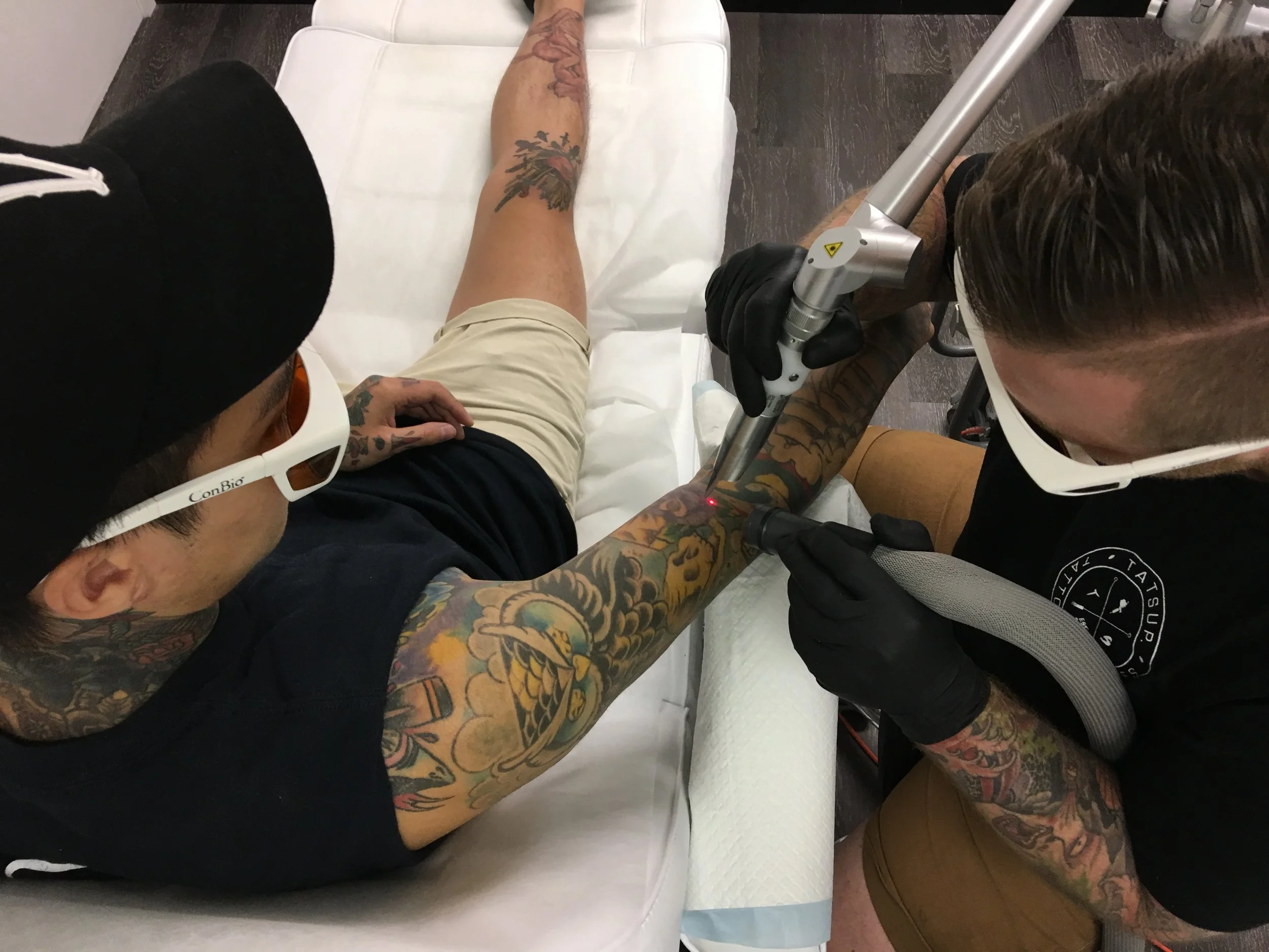 old-tattoo-removal-results.JPG