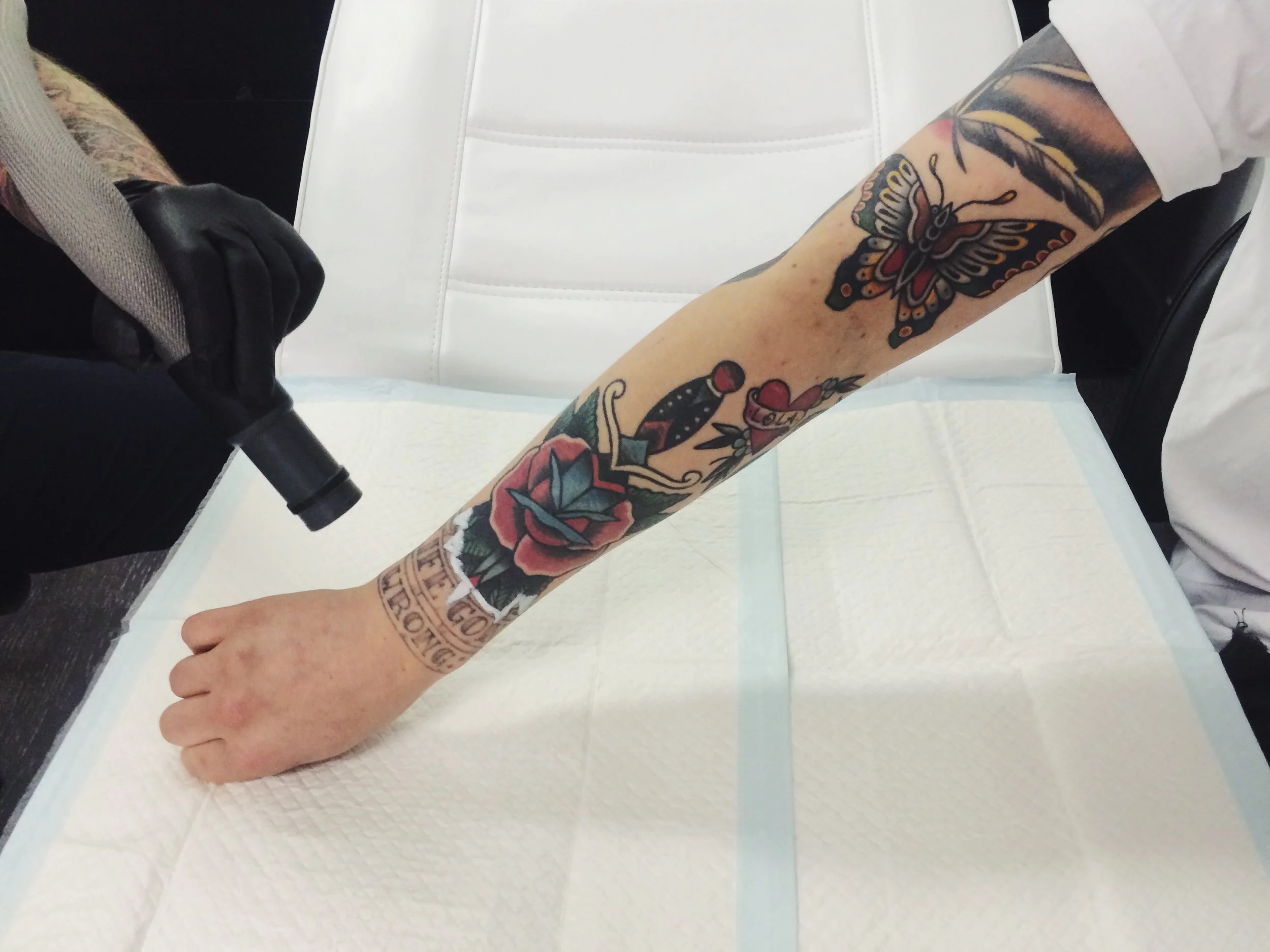 tattoo-removal-fading-process.JPG