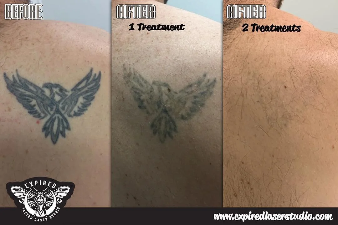 After just 2 treatments for this beast!
The secret here with this one was patience, the time difference between the the middle picture and the right picture was a staggering was nearly 16 months! 
We want results just as much as our clients do so we 