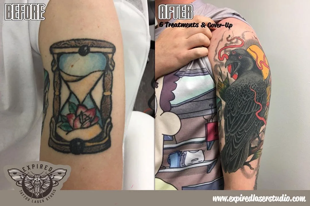 After 6 treatments Luke got a nice upgrade by the great @drewshallis. Took a few extra treatments due to the colour but everyone is stoked in the end. Thanks Luke!@the_dreadfort
☎️ 02 6195 0873
📧 info@expiredlaserstudio.com
💻 expiredlaserstudio.com