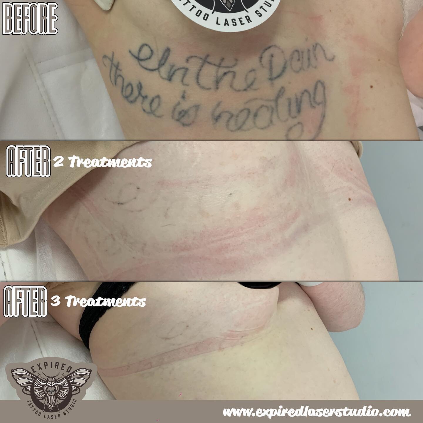 Let&rsquo;s talk &ldquo;home-job tattoo&rsquo;s&rdquo;.
When it comes to result expectations with non-professional tattoo&rsquo;s generally they treat a whole lot better than professional tattoo&rsquo;s. The ink&rsquo;s used are questionable and in s