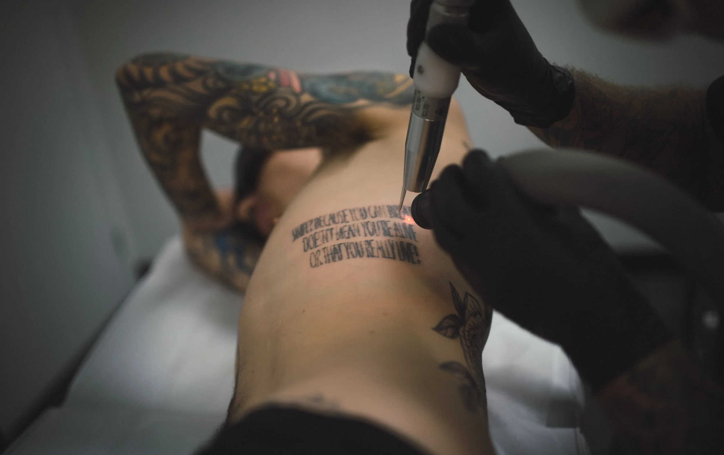 NBD_0262laser-tattoo-removal-treatment-canberra.jpg