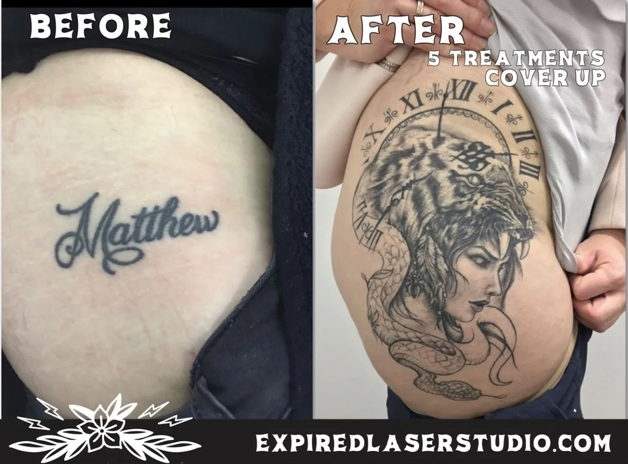 coloured-tattoo-removal-canberra.jpg