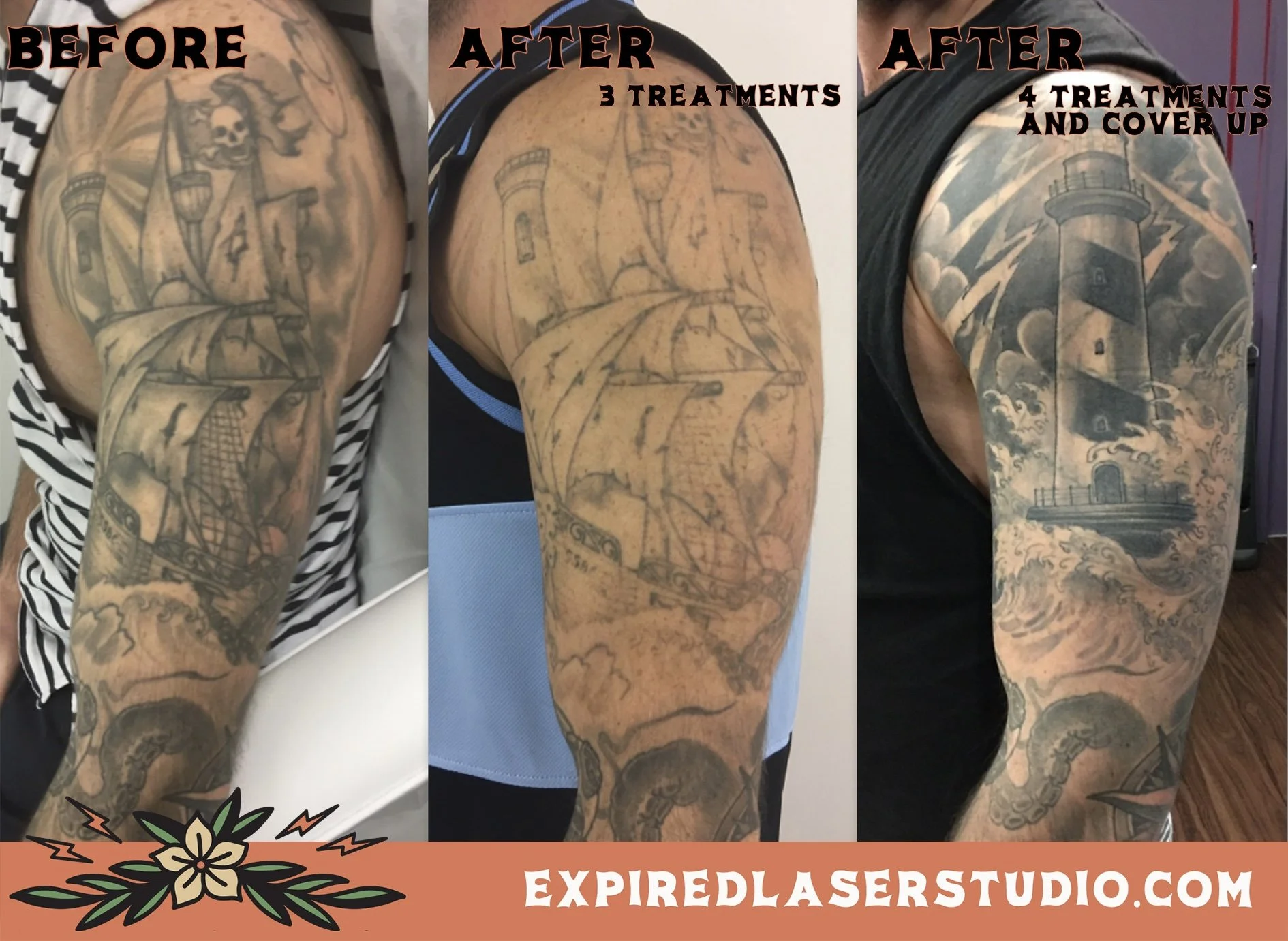 neck-tattoo-removal-before-after.jpg