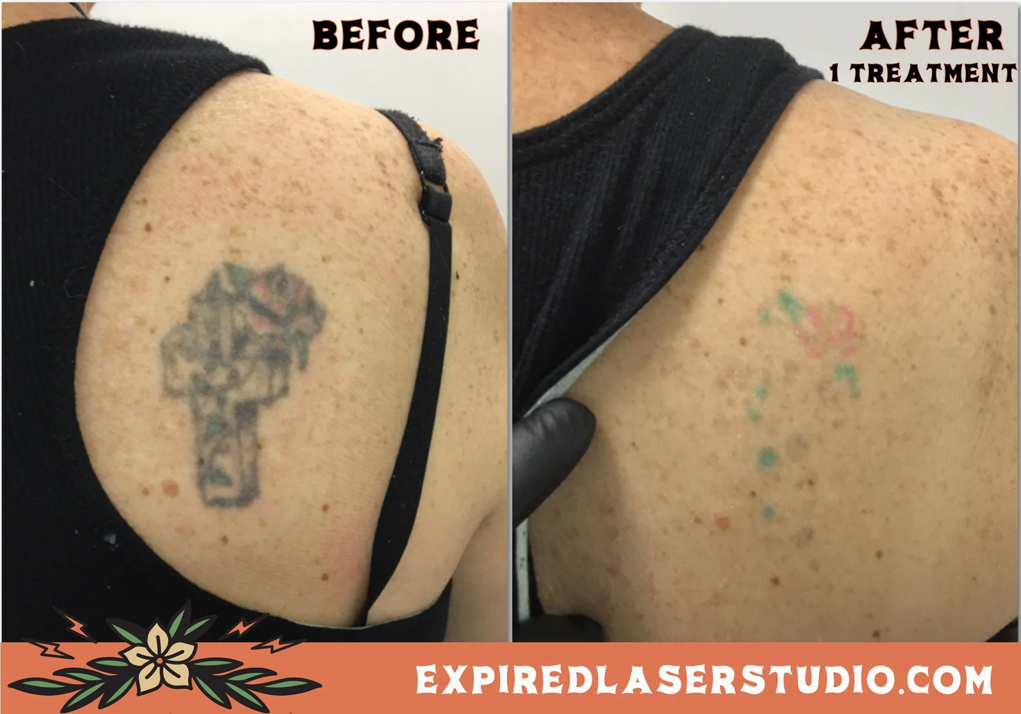 tattoo-fading-for-cover-up-canberra.jpg
