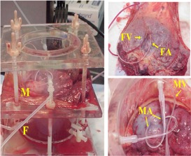 In vitro placental perfusion1.jpg