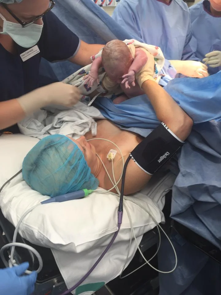 Maternal Assisted Ceasarean 