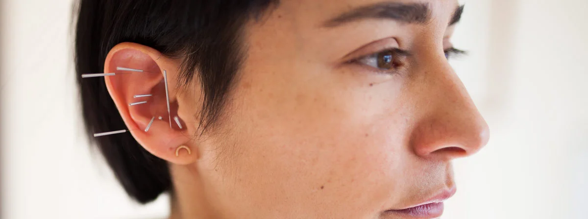 auricular-acu.jpg