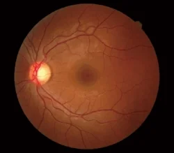 retina.jpg