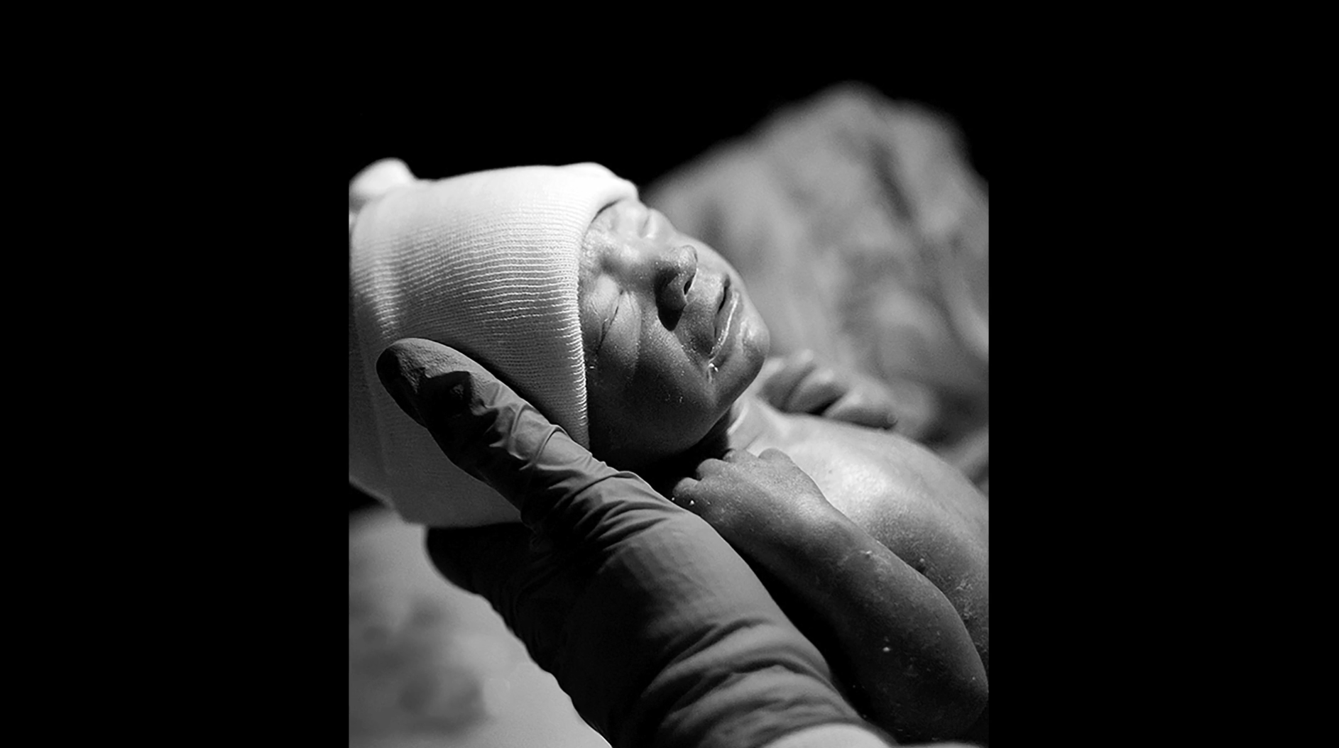Hoag - NICU