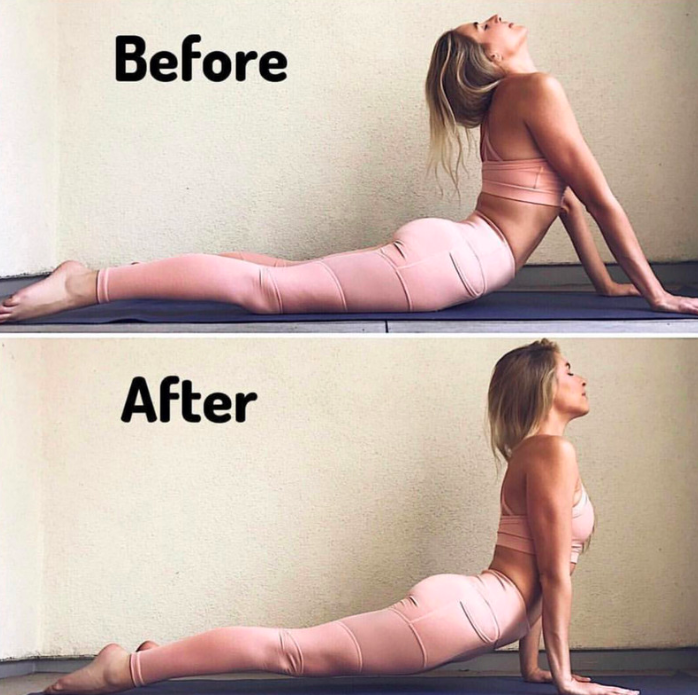 Upward Facing Dog (Urdhva Mukha Svanasana)