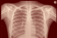 Discerning Our Idols: X-Ray Questions