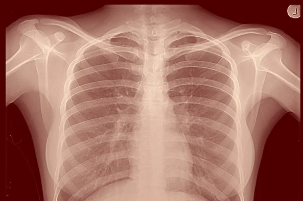 Discerning Our Idols: X-Ray Questions