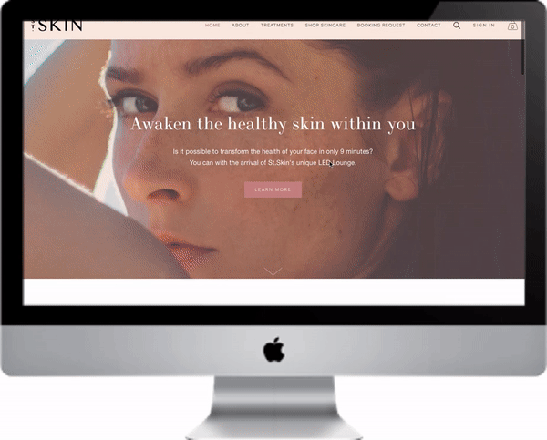 stskin-gif.gif