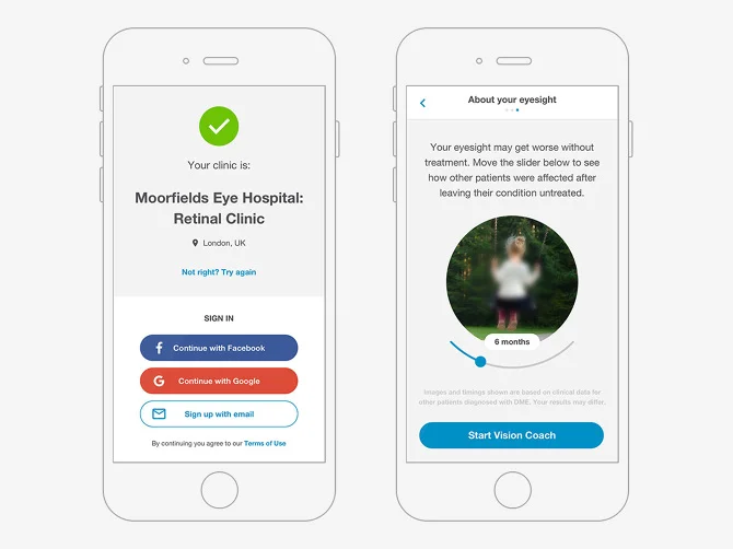 Loss aversion exercise to create an emotional investment in the app