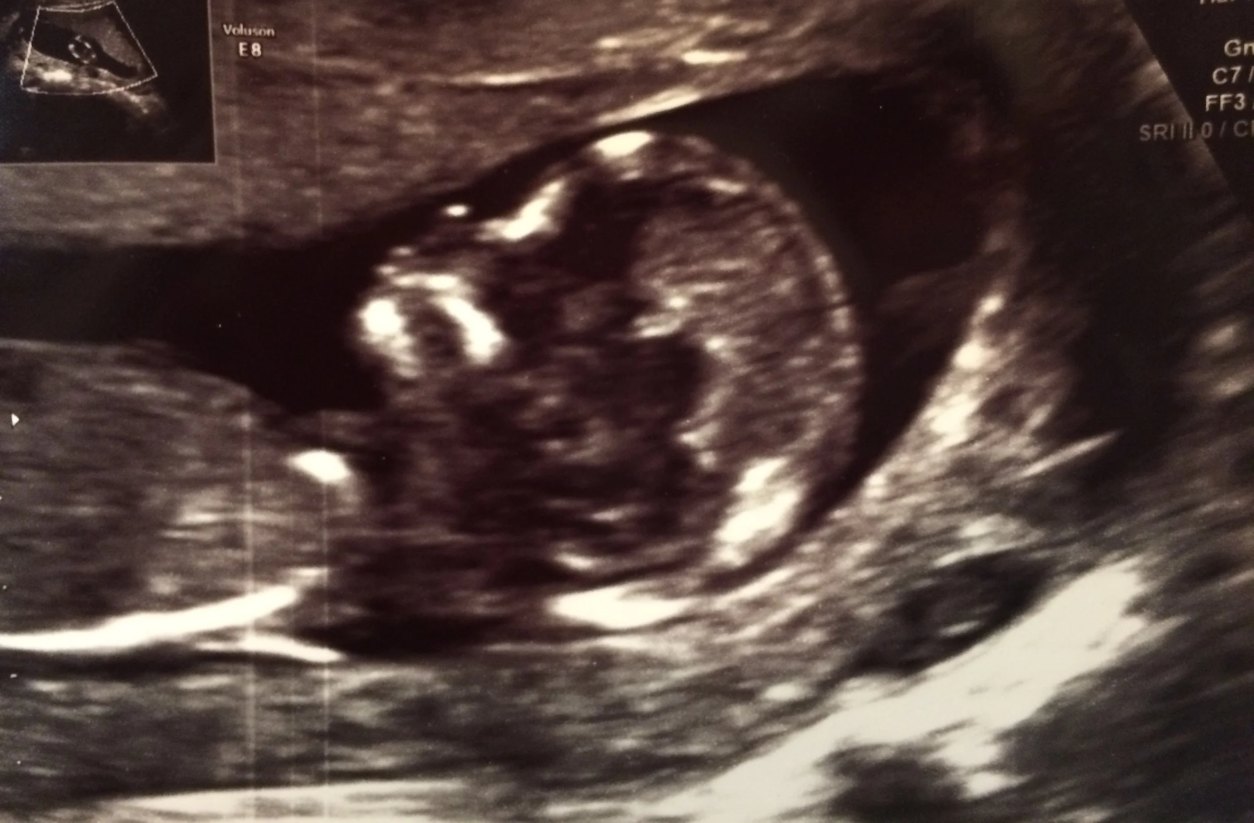 baby.JPG