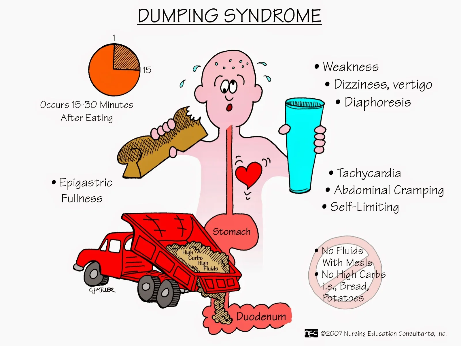 Dumping Syndrome.jpg