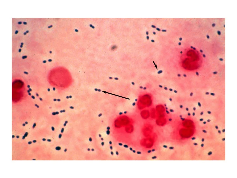 s-pneumoniae.jpg