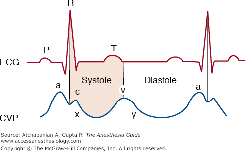 A venous tracing on CVP