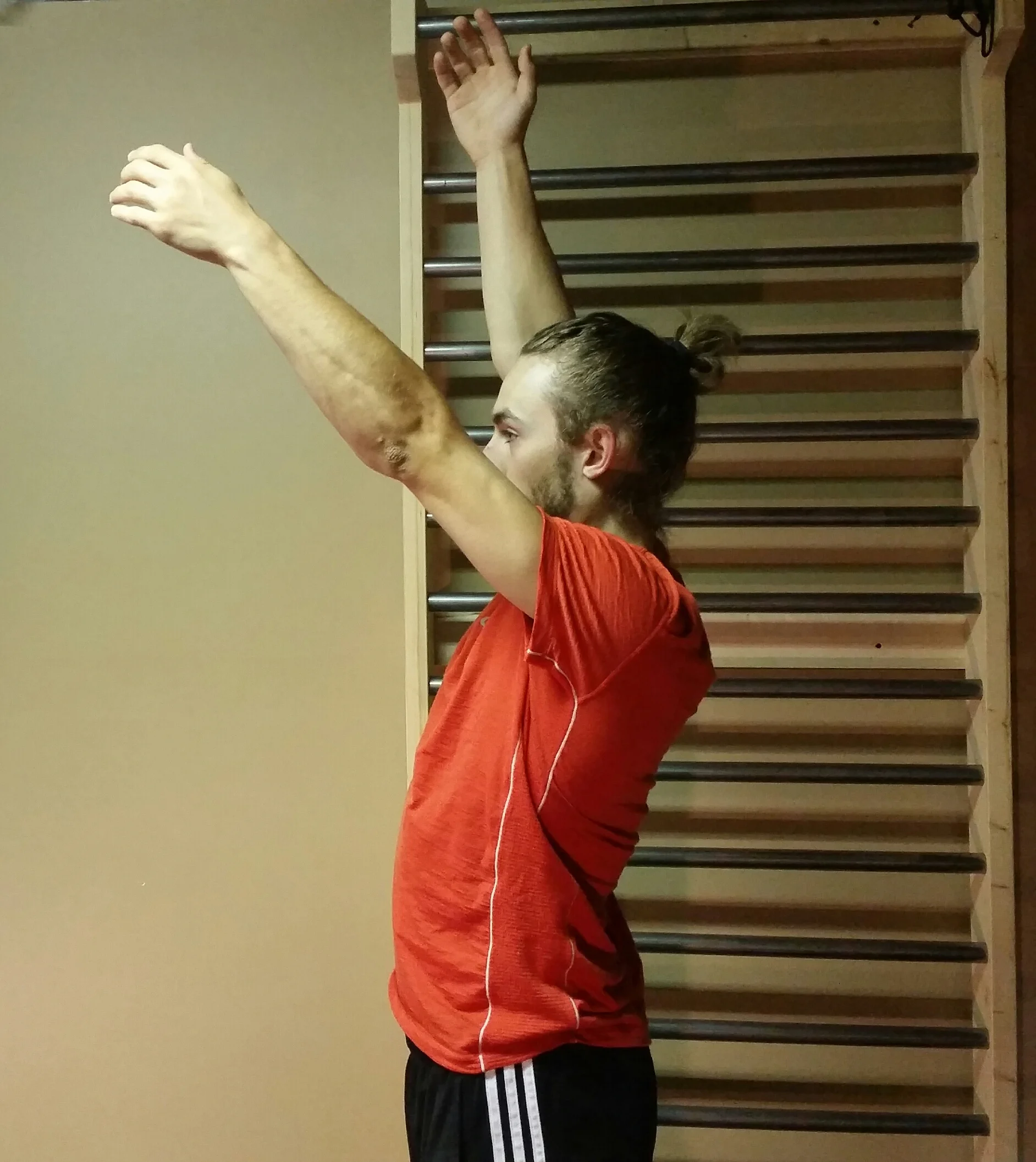 Asymmetrical shoulder ROM. Common with injuries or jobs that require unilateral work,