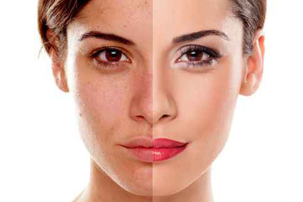 before-after.jpeg