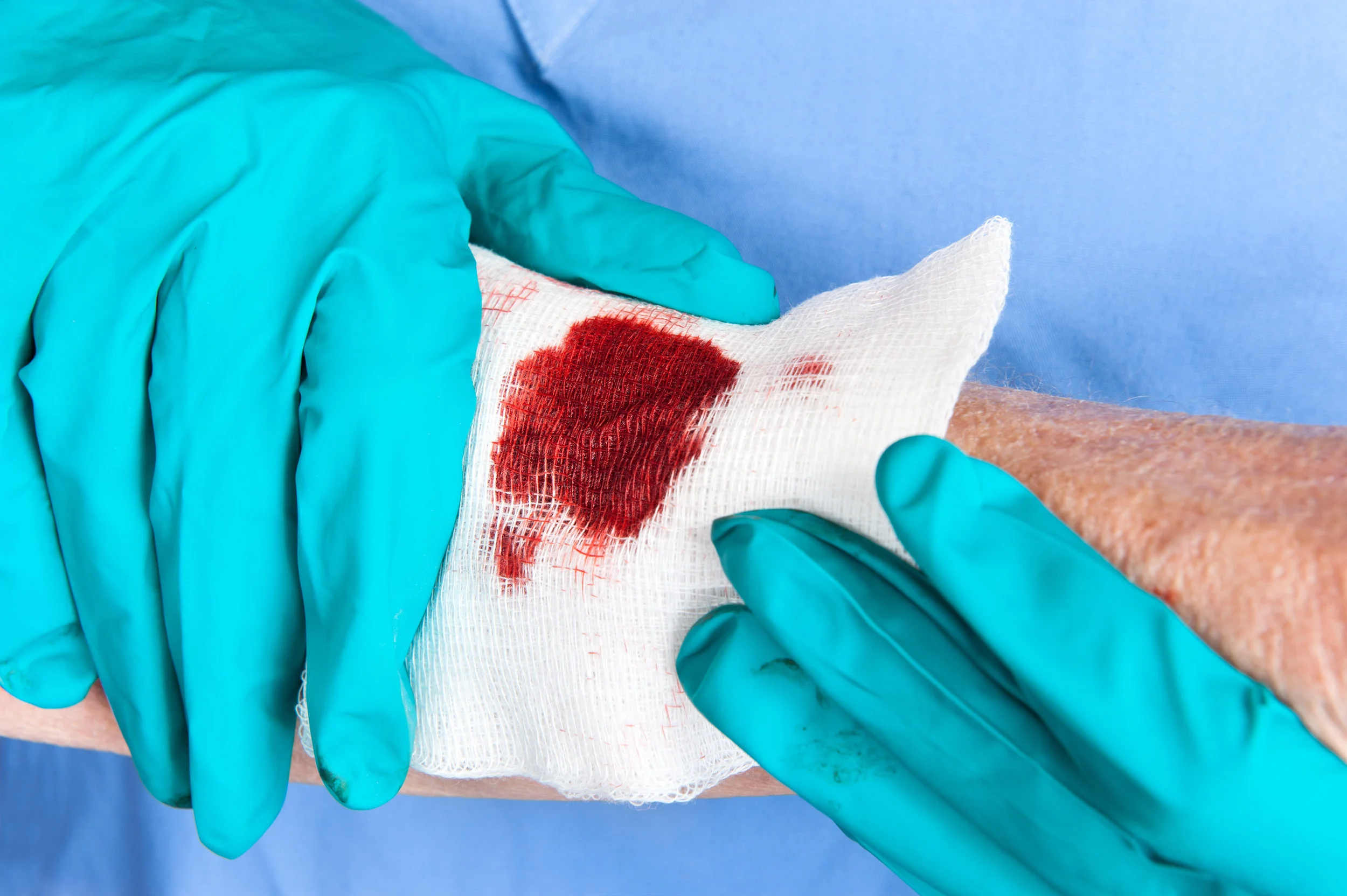 Bloodborne Pathogens - Protecting Workers