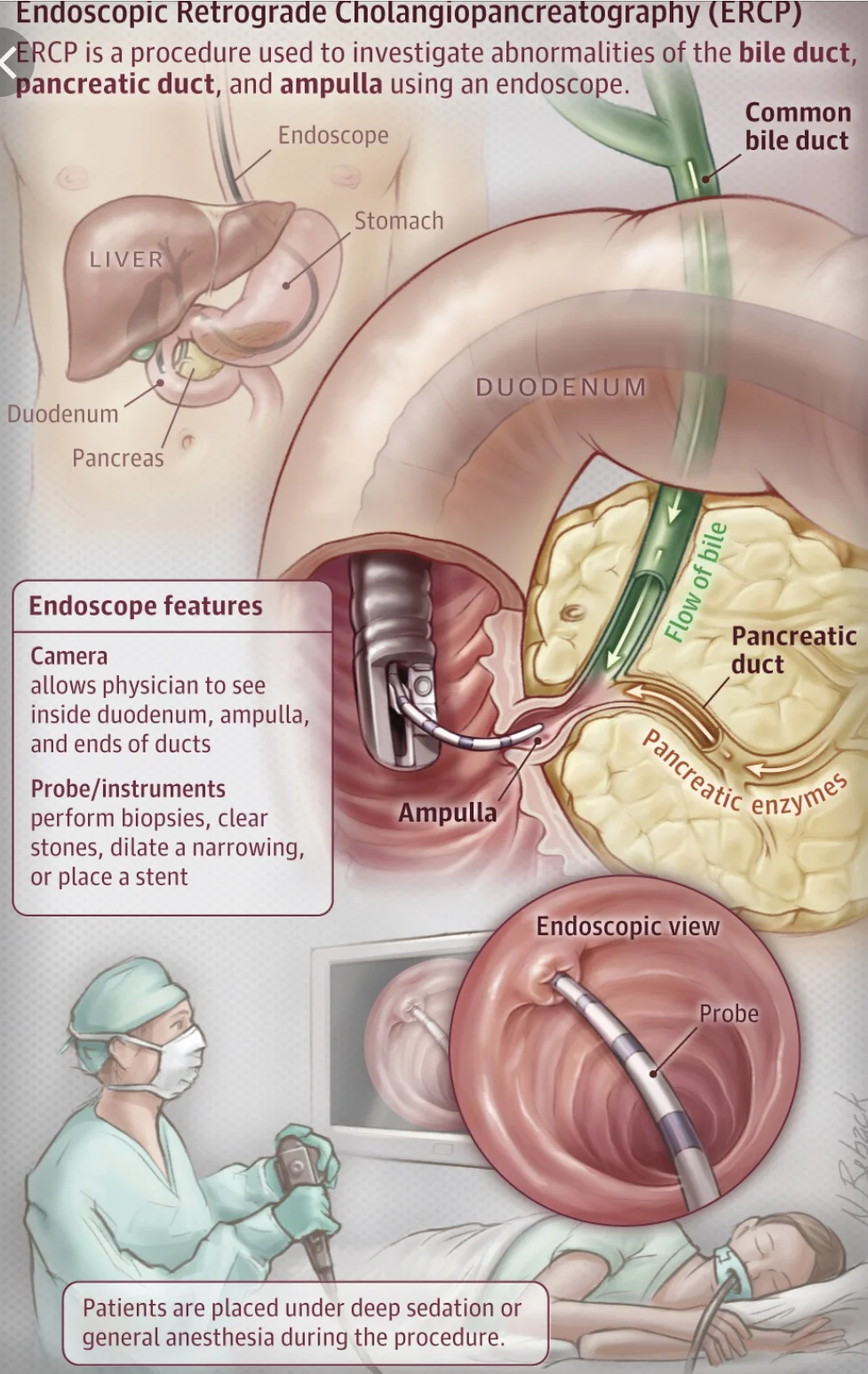 ERCP Again. — Gather with Jim