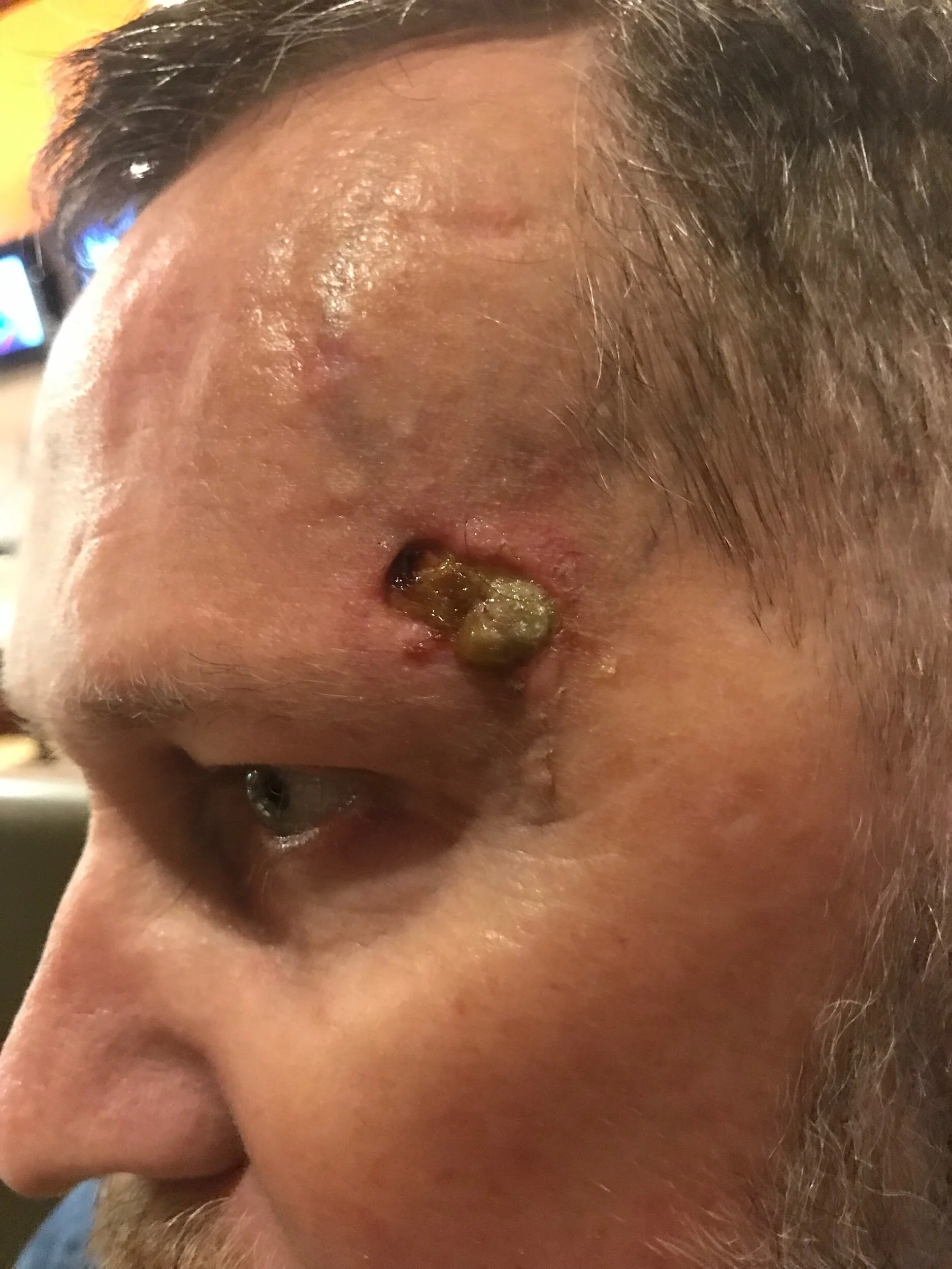 Yup, it’s gross.