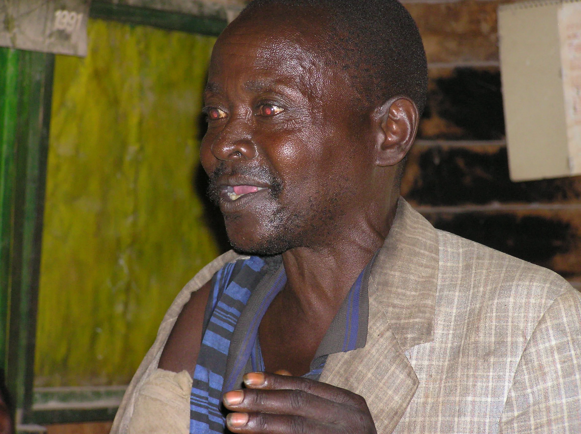 Amputee benefactor of seed distribution program