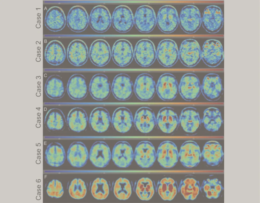 DIAGNOSE CTE-II