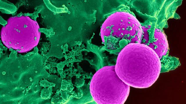 Bacteria (MRSA shown here)