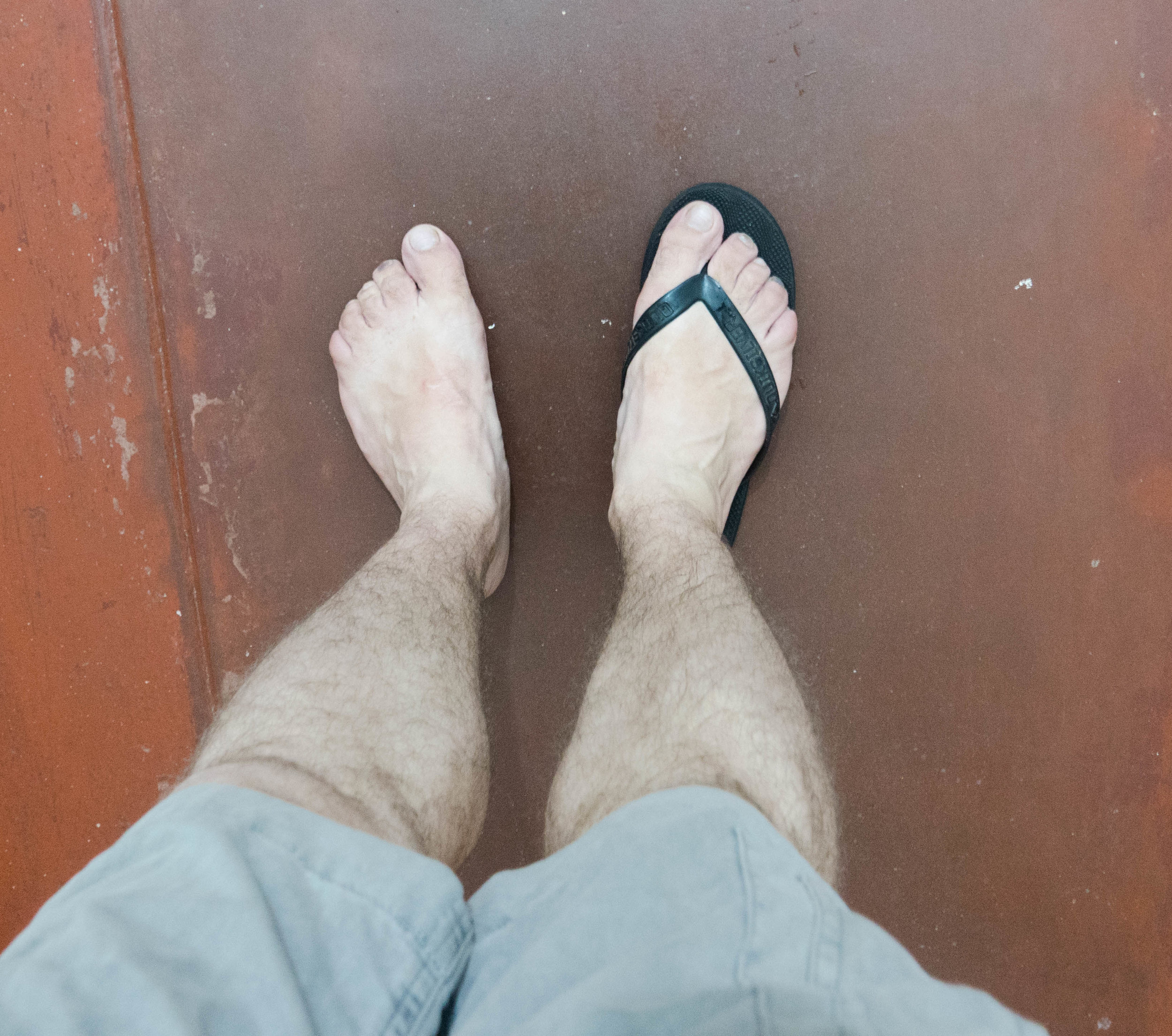 Norbert of eRunCoach.com shows his feet before wearing Correct