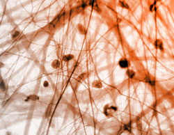 About Jfb Myofascial Release Body Wisdom