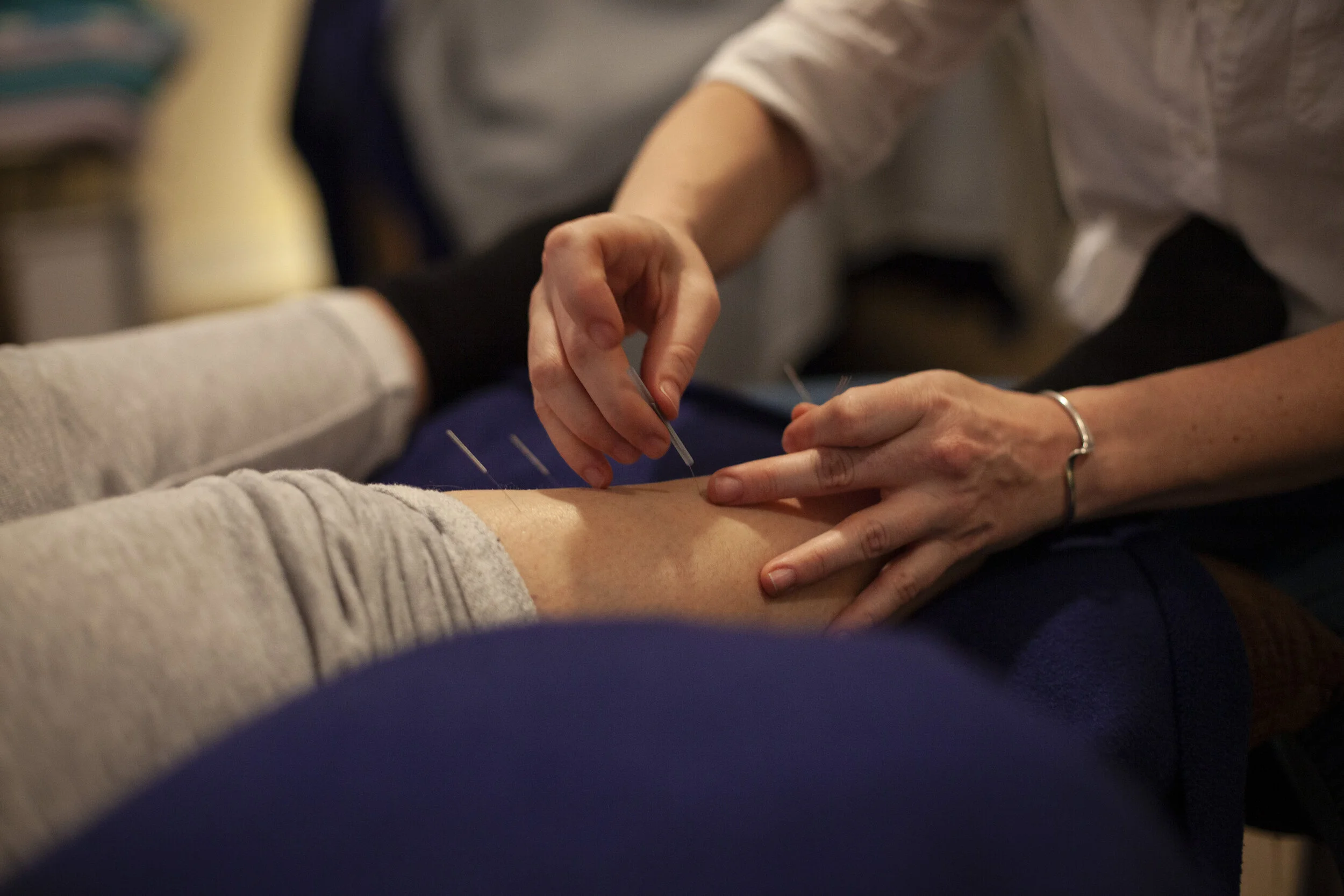 Leg and needles.JPG