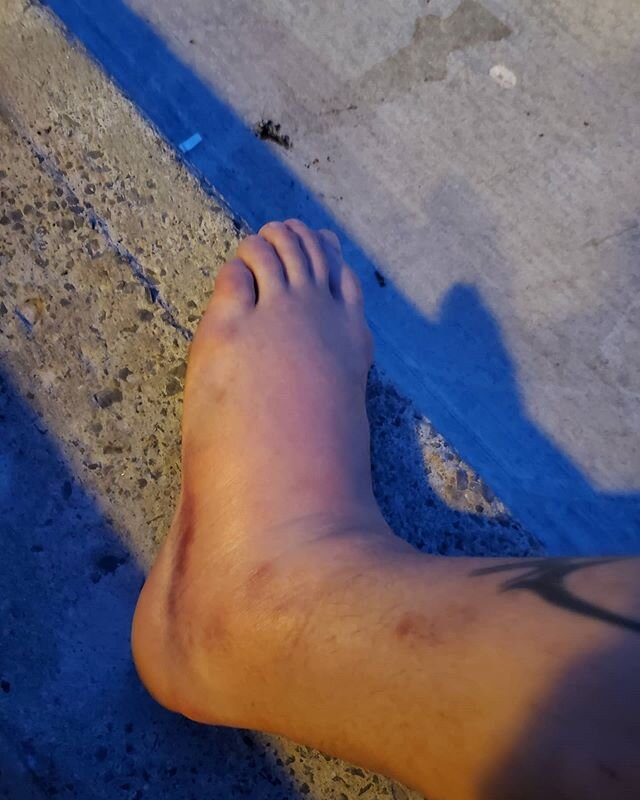 Broke my foot (not a parkour injury) so I'll be out of commission for a bit. Everyone else has to be awesome on my behalf for a few weeks please!