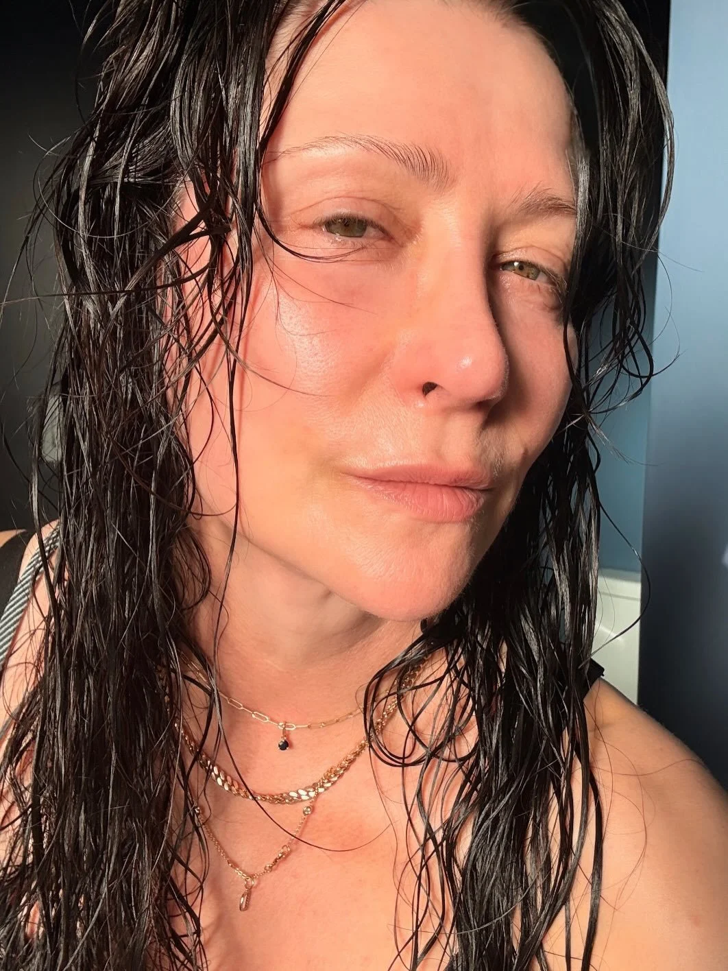 Shocking to get to this place with my skin! So many falls on my face (🥺). Many accidental curling iron burns (🥵) and many many many treatments &amp; lasers. 

Grateful for all of the product support from companies over the years. Grateful for my nu