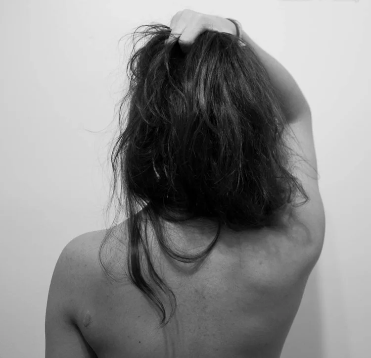 "I used to be extremely conscious of my scar, but over time I've developed more confidence and see it less as a flaw and more as something that is beautiful about my body."