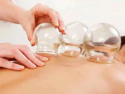 This is cupping being done correctly.  It doesn't look impressive, but it has to be felt to be understood.